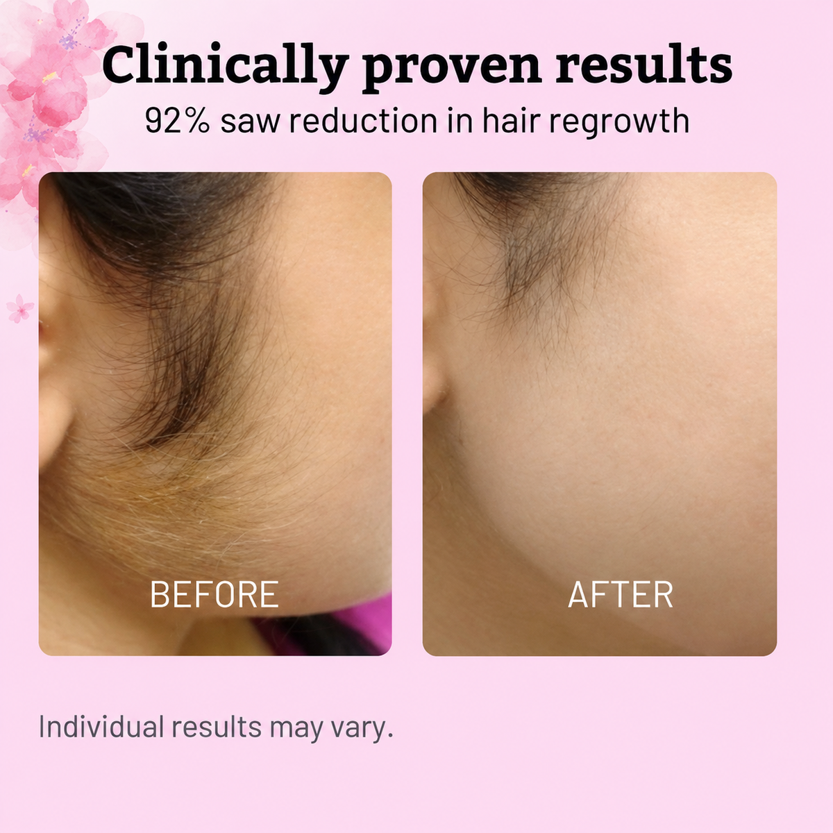 Cyperus Rotundus Oil - 60ml Natural Cyperus Rotundus Oil For Hair Removal, Moisturizing & Soothing Cyperus Oil For Reducing Body Hair Growth, Hair Removal Oil Ideal for All Skin Types