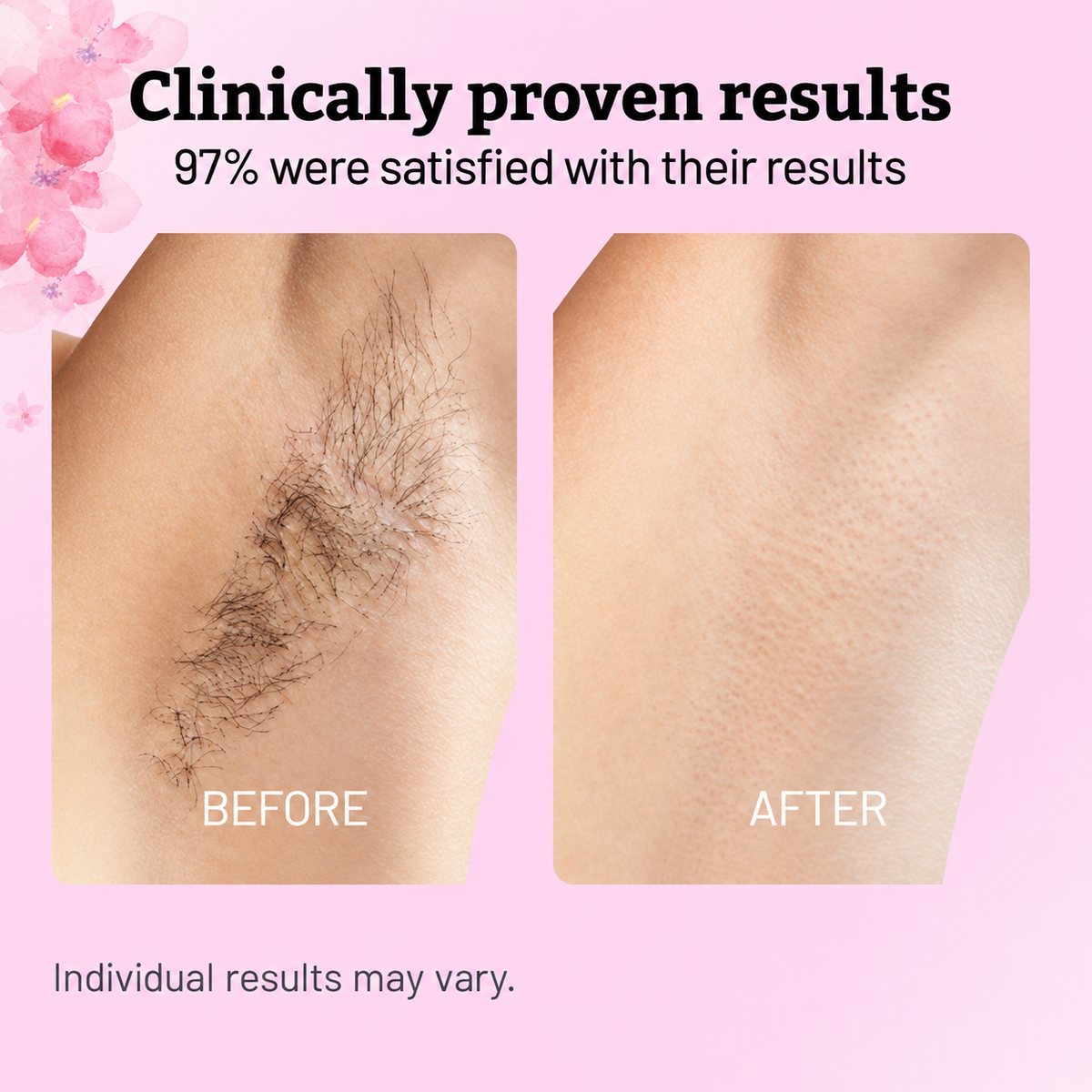 Cyperus Rotundus Oil - 60ml Natural Cyperus Rotundus Oil For Hair Removal, Moisturizing & Soothing Cyperus Oil For Reducing Body Hair Growth, Hair Removal Oil Ideal for All Skin Types
