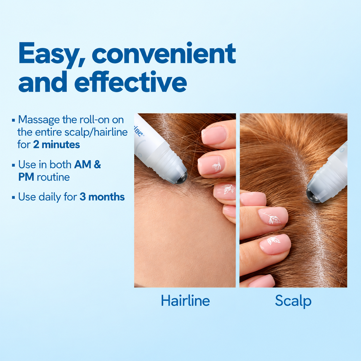 Bodywise Advanced Hair Growth Serum Roll On- For Hair Thinning, Herbal- (25ml)